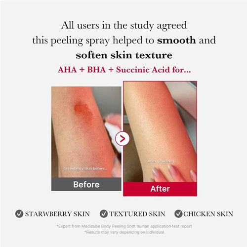 MEDICUBE Red Acne Body Peeling Shot 2.0 110g — product image 2
