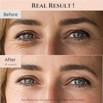 Beauty of Joseon Revive Eye Serum : Ginseng + Retinal 30ml — product image 3