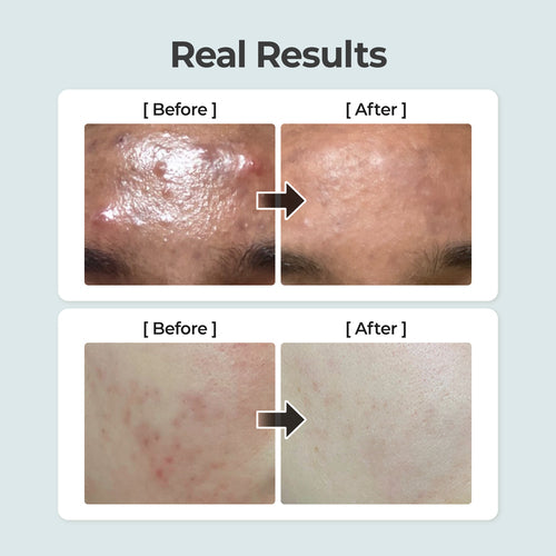 Numbuzin No.1 Pure-full Calming Herb Toner 300ml — product image 3