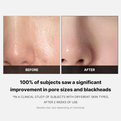 MEDICUBE Zero Pore Pad 2.0 (70ea) — product image 5