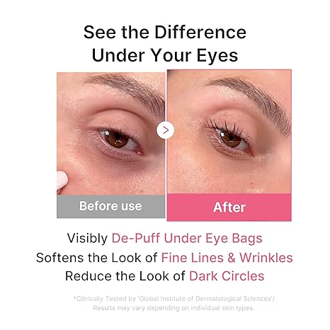 MEDICUBE PDRN Pink Collagen Jelly Eye Mask (50 pouch) — gallery view 4